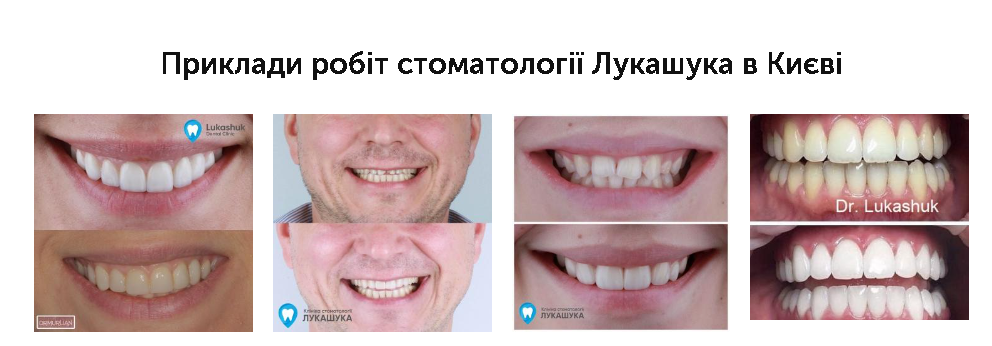 зуби