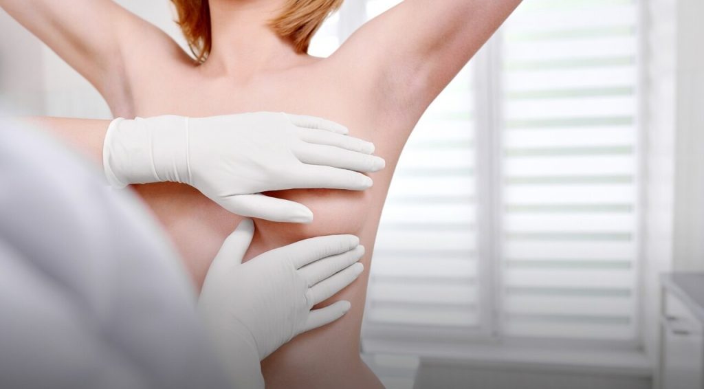 Рак молочної залози