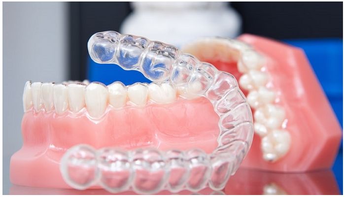 Капа для зубів