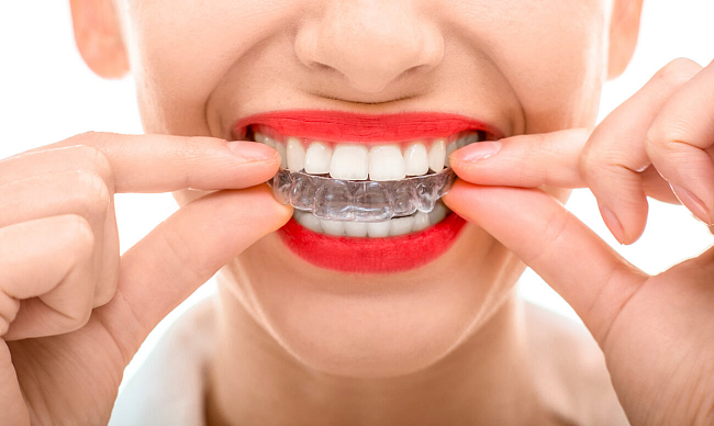 Капа для зубів