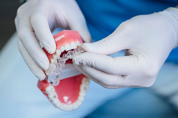 Капа для зубів