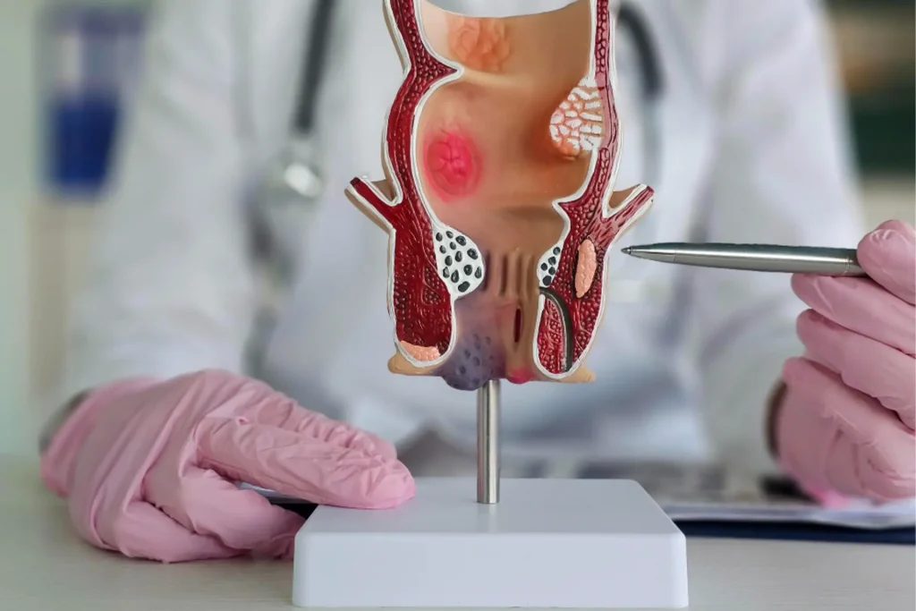 Огляд у проктолога