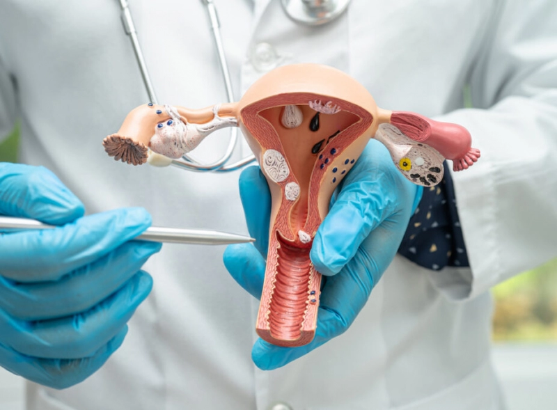 дисплазія шийки матки