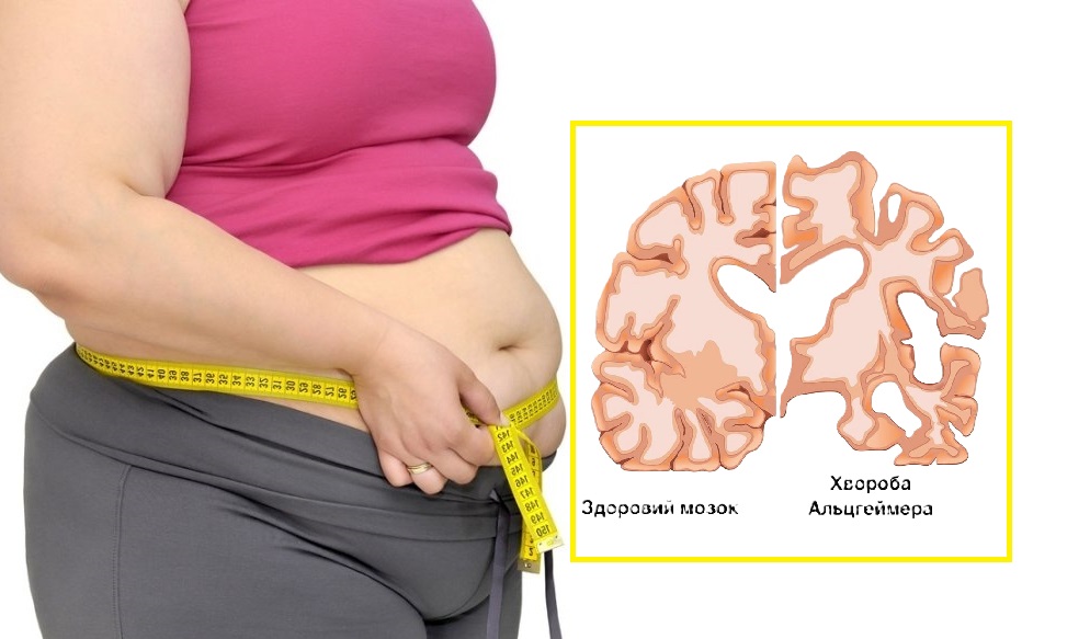 надмірна вага