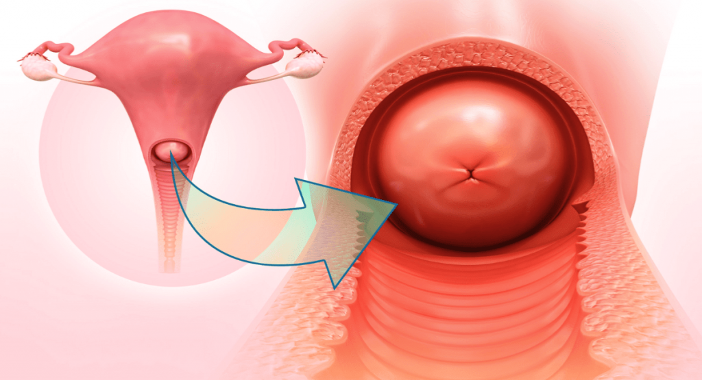 Шийка матки