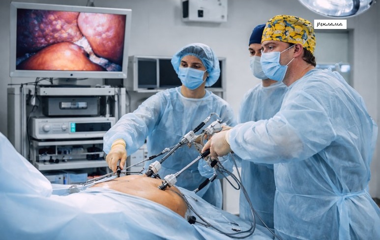 камені загальної жовчної протоки