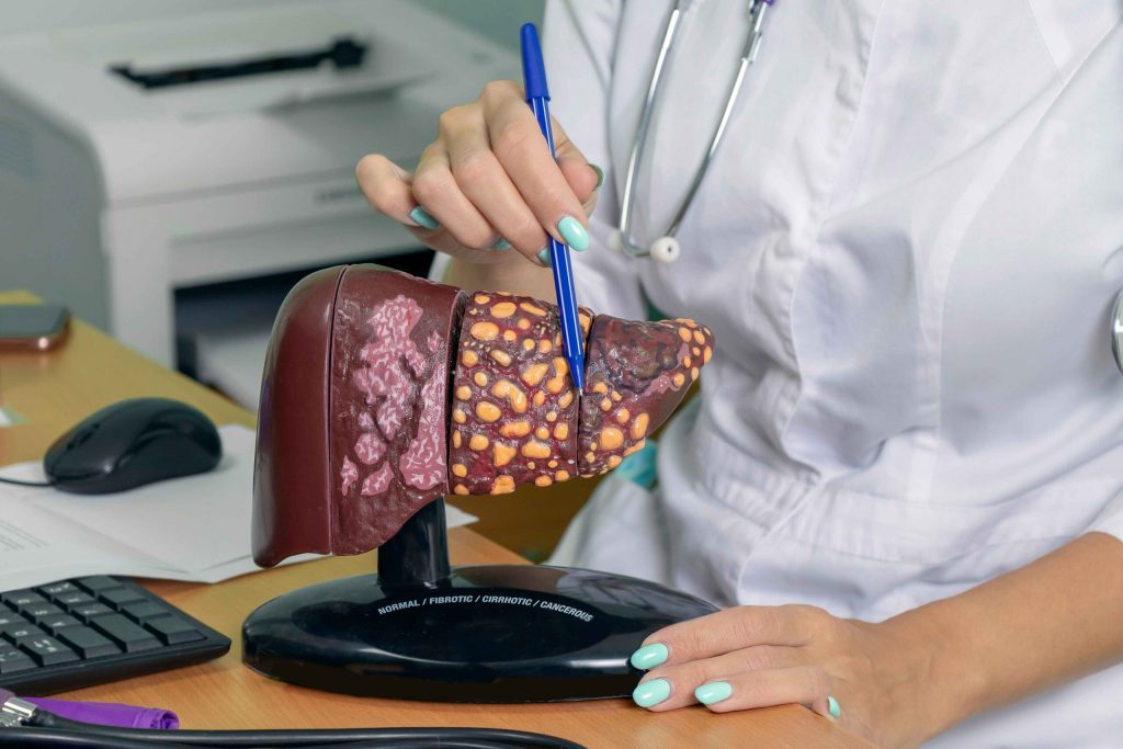 Рак печінки часто починається безсимптомно