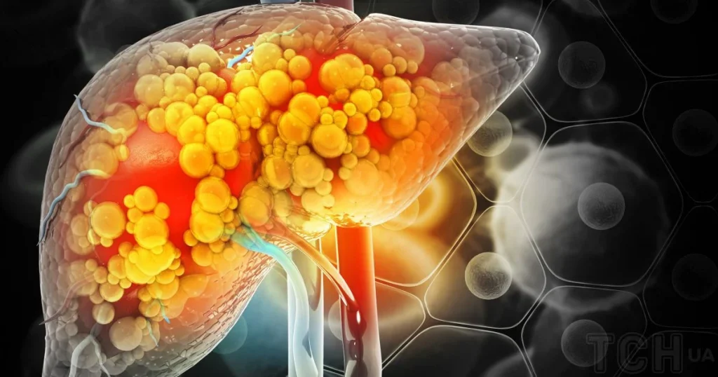 здоров'я печінки