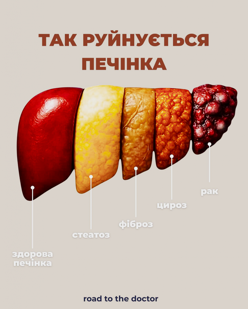 Захворювання печінки